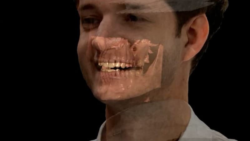 Treatment 3