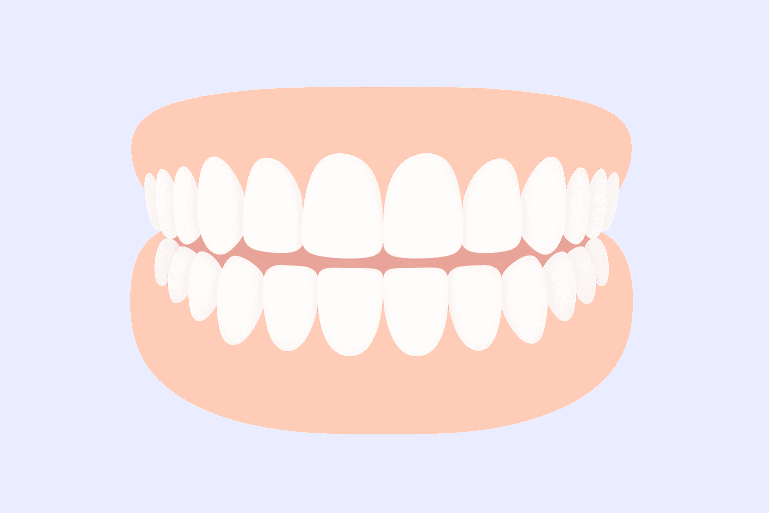 Open bite